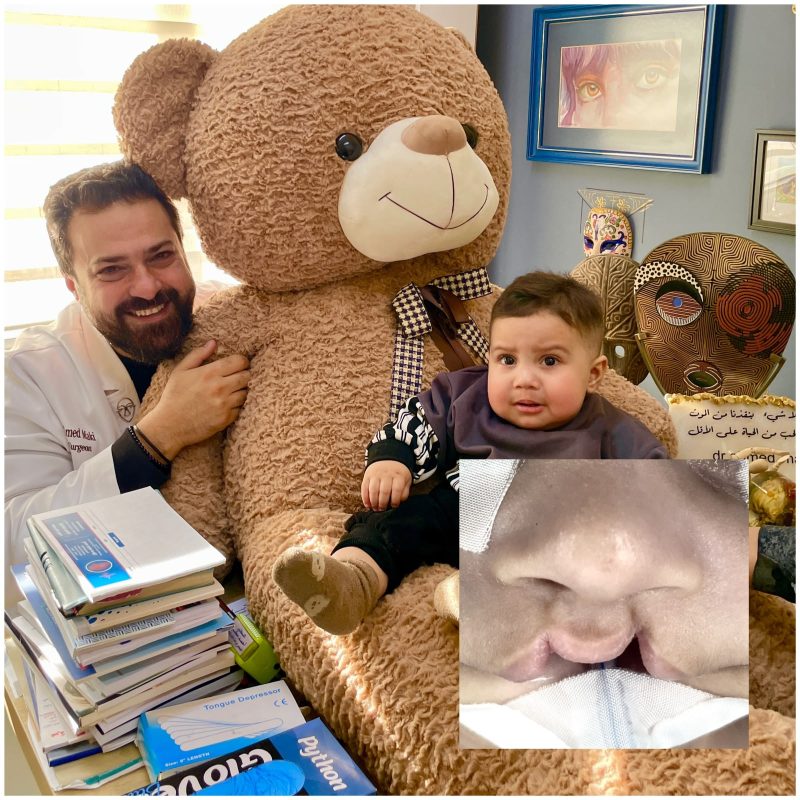 ترميم الوجه