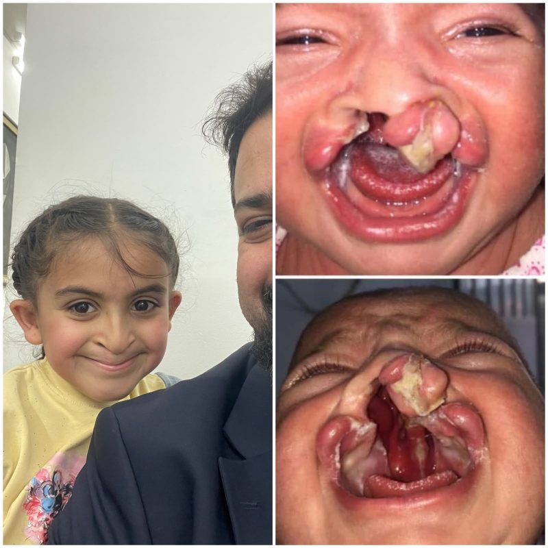 عودة الابتسامة